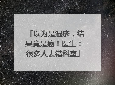 以为是湿疹，结果竟是癌！医生：很多人去错科室