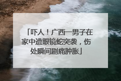 吓人！广西一男子在家中遭眼镜蛇突袭，伤处瞬间剧痛肿胀